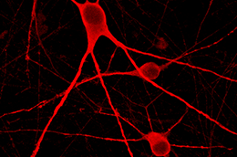ioMotor Neurons