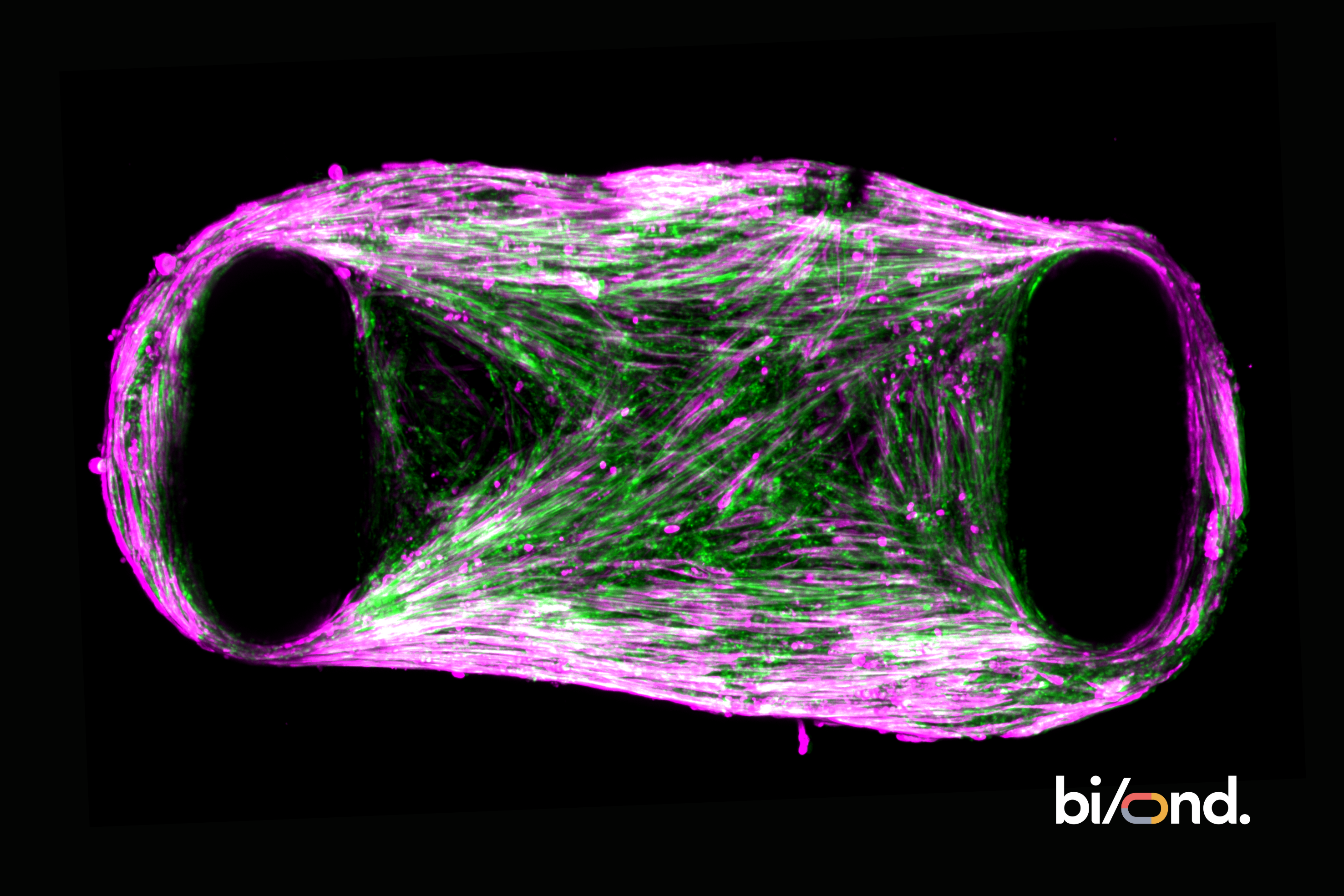 Generation of human iPSC-derived Duchenne muscular dystrophy skeletal myocytes suitable for 3D functional studies and investigating methods for dystrophin restoration