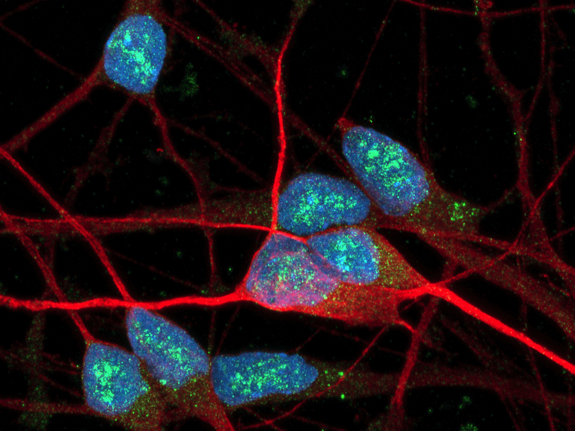 Close-up image of several neurons, nuclei stained blue (DAPI) and cell bodies stained red (MAPT)