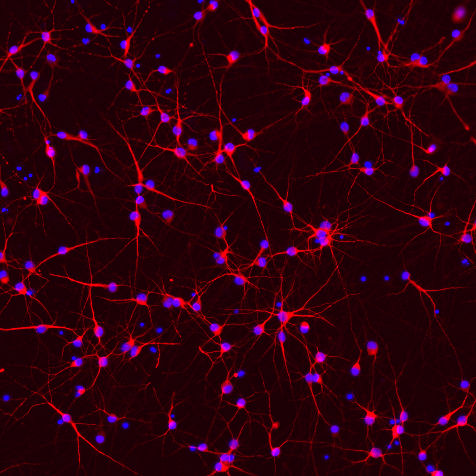 ioGlutamatergic Neurons PINK1 Q456X/WT