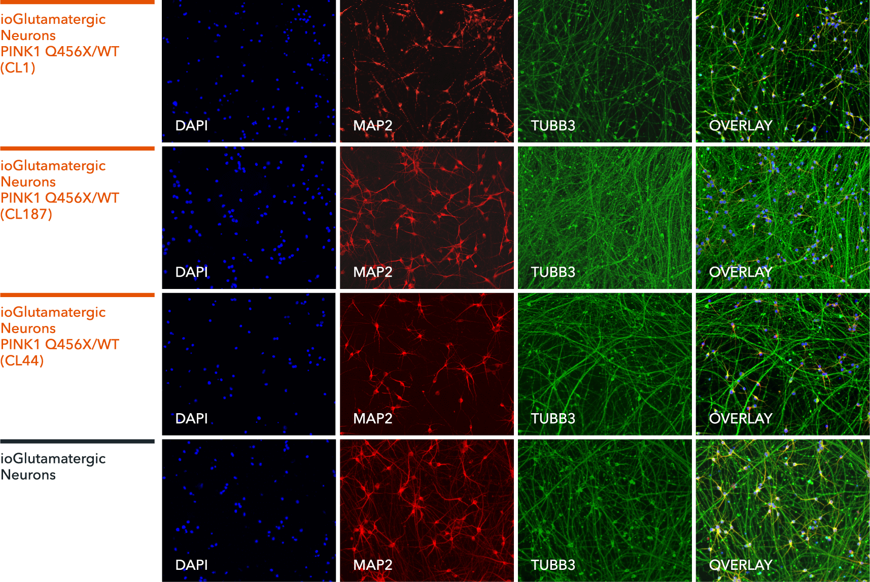 io1078-io1079-io1080-ioGlutamatergic Neurons-PINK1-Q456X-het-ICC-MAP2-TUBB3