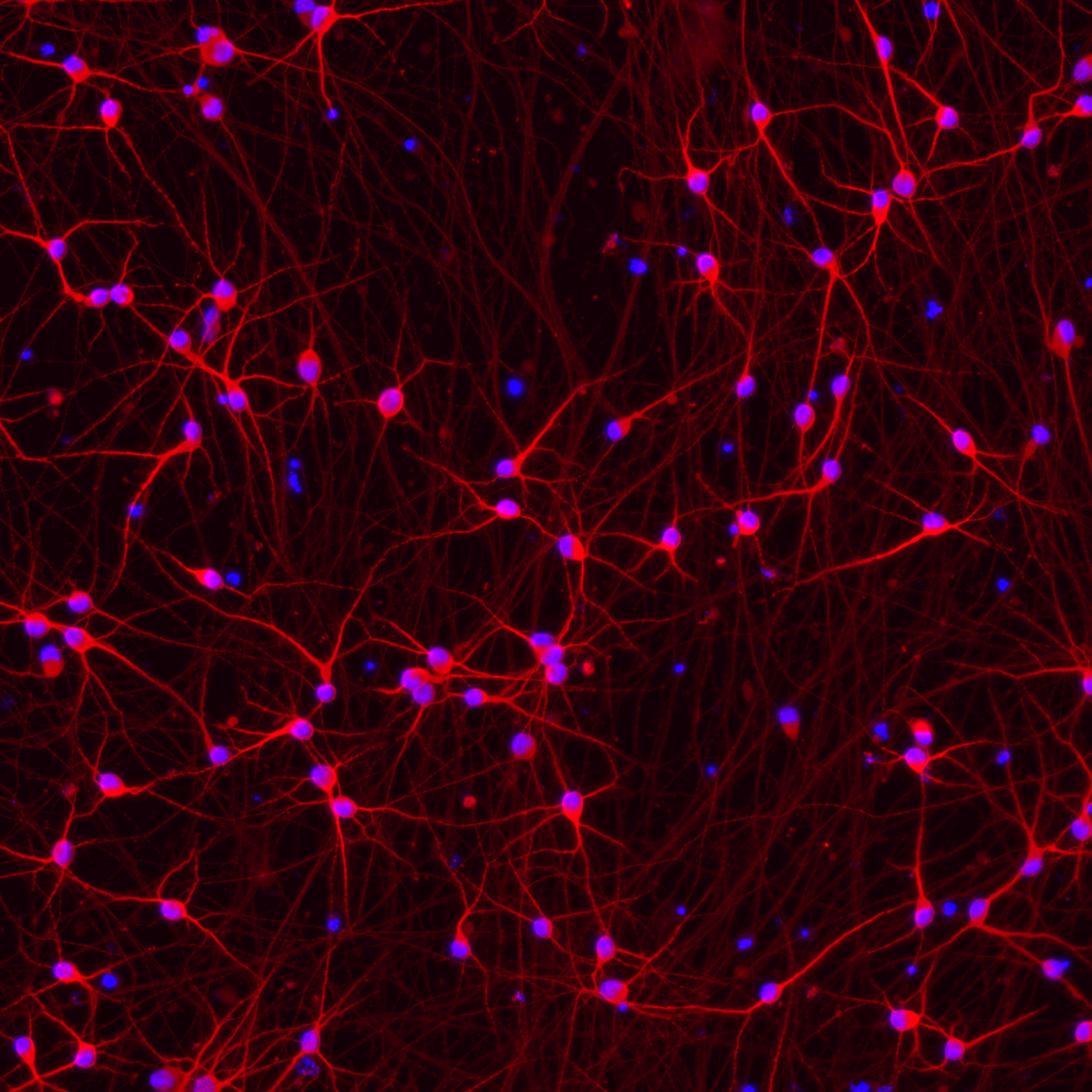 ioGlutamatergic Neurons PINK1 Q456X/Q456X