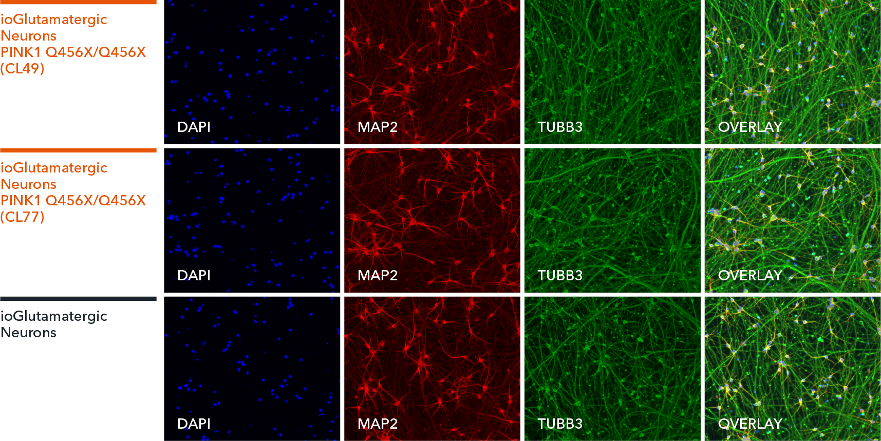 io1075-io1076-ioGlutamatergic Neurons PINK1-Q456X-hom-ICC-MAP2-TUBB3