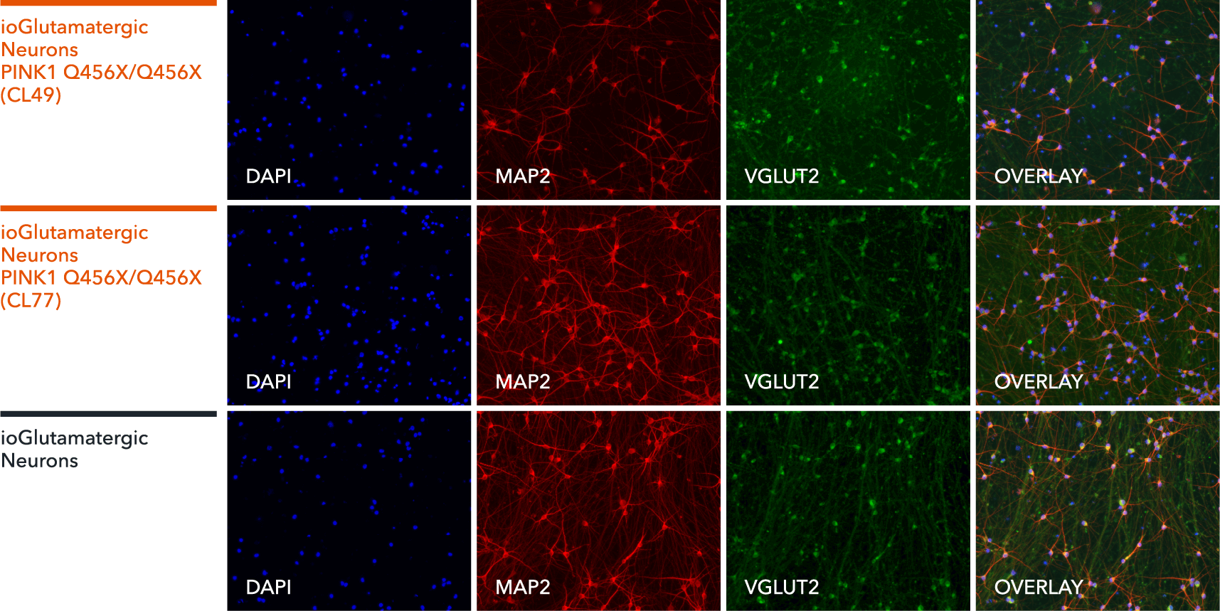 io1075-io1076-ioGlutamatergic Neurons PINK1-Q456X-hom-ICC-MAP2-VGLUT2