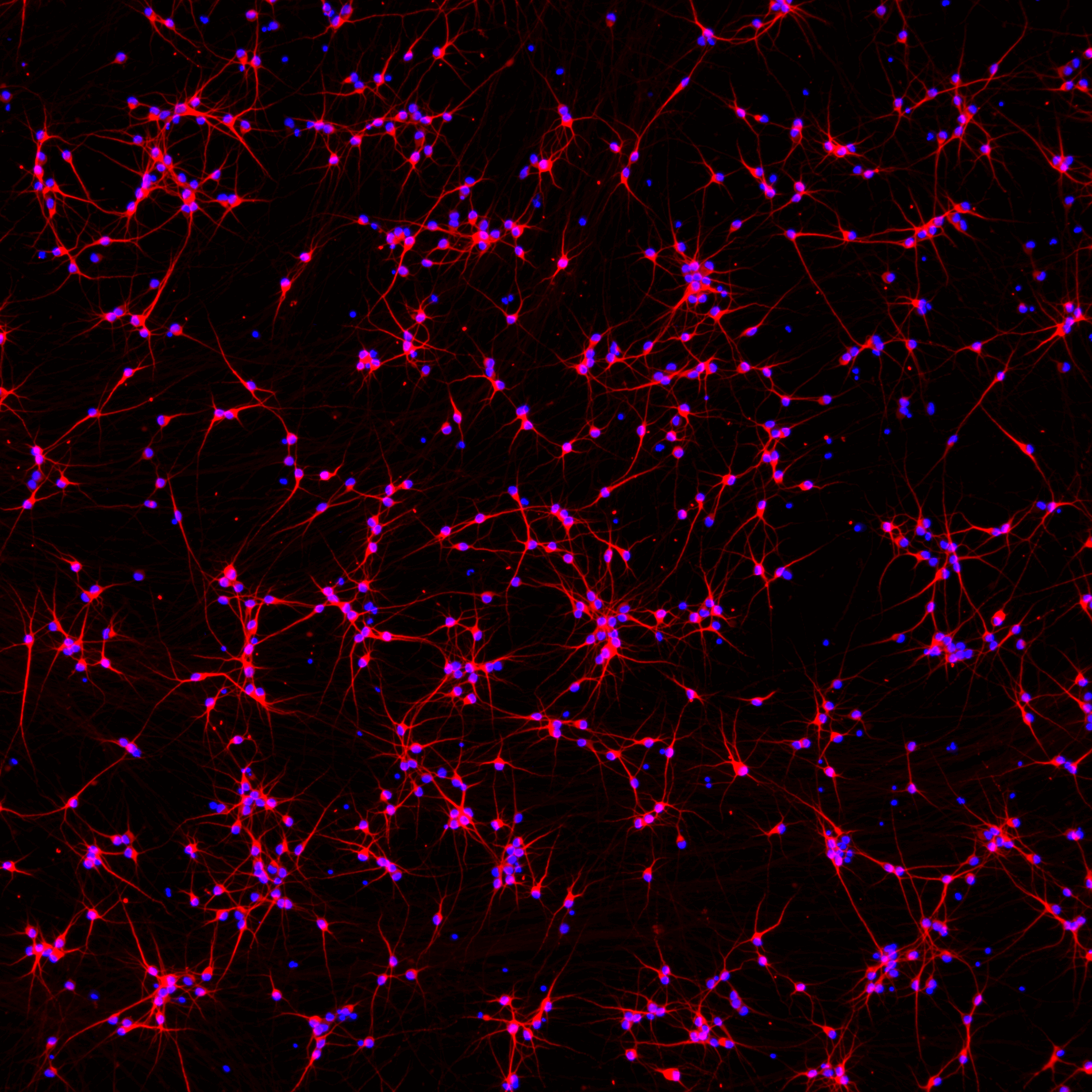 Hero-SNCA-A53T-het-ICC-DAPI-MAP2