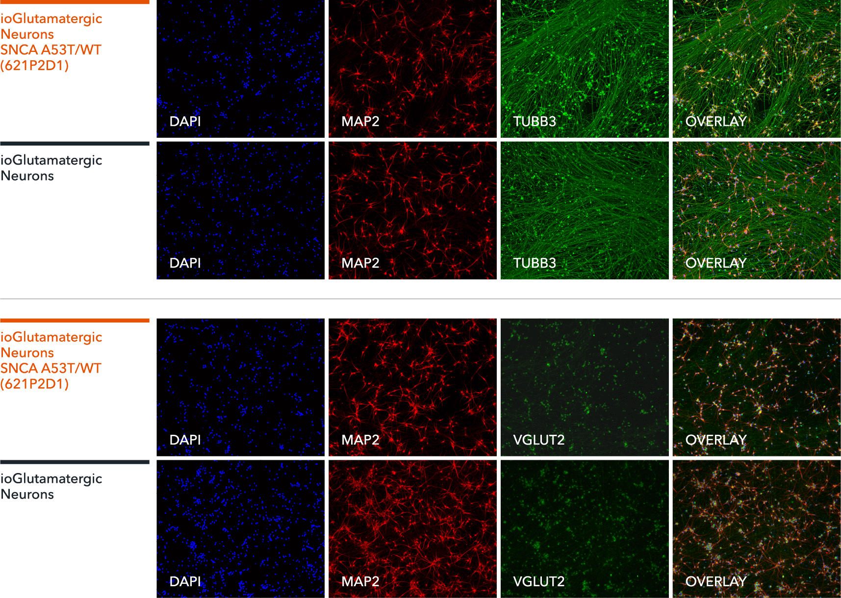 SNCA-A53T-het-io6005-ICC-MAP2-TUBB3-VGLUT2
