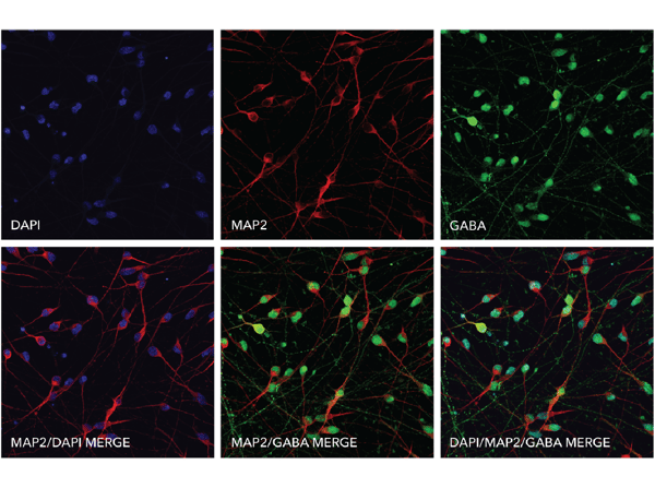 GABAergic Neurons ICC - expression of key markers at protein level