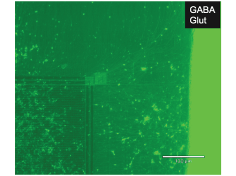 GABAergic Neurons in co-culture brightfield