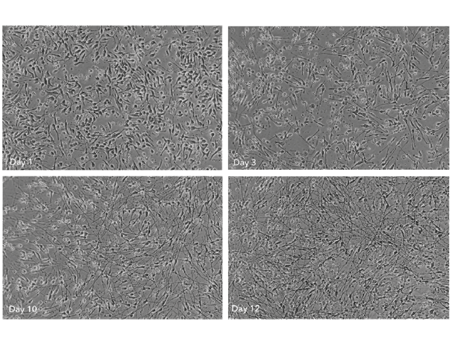 GABAergic Neurons morphology brightfield