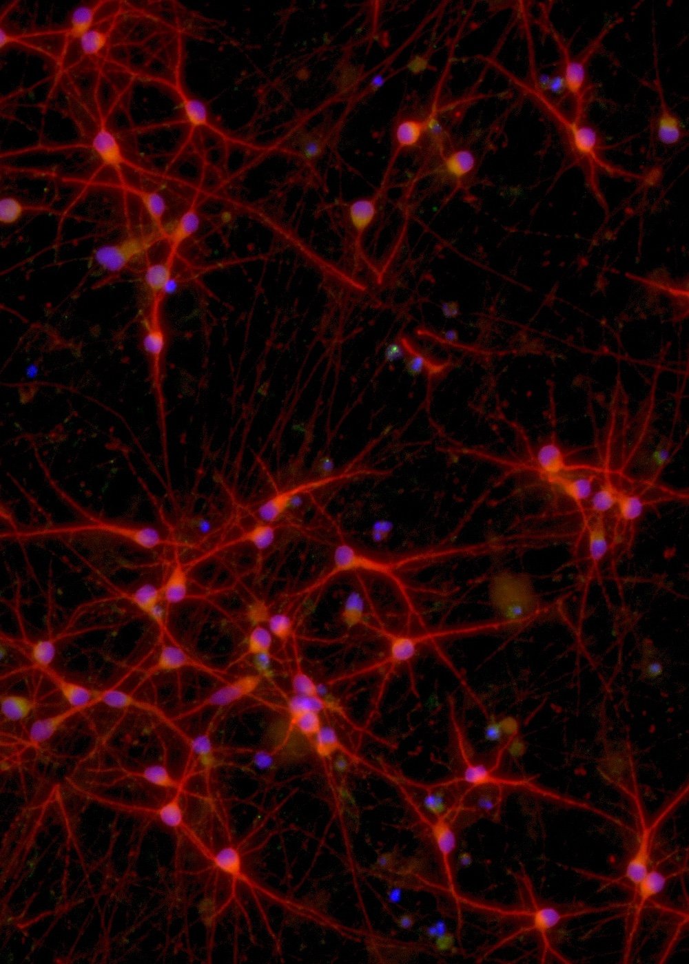 Glutamatergic Neurons MAPT P301S/P301S | ioCells