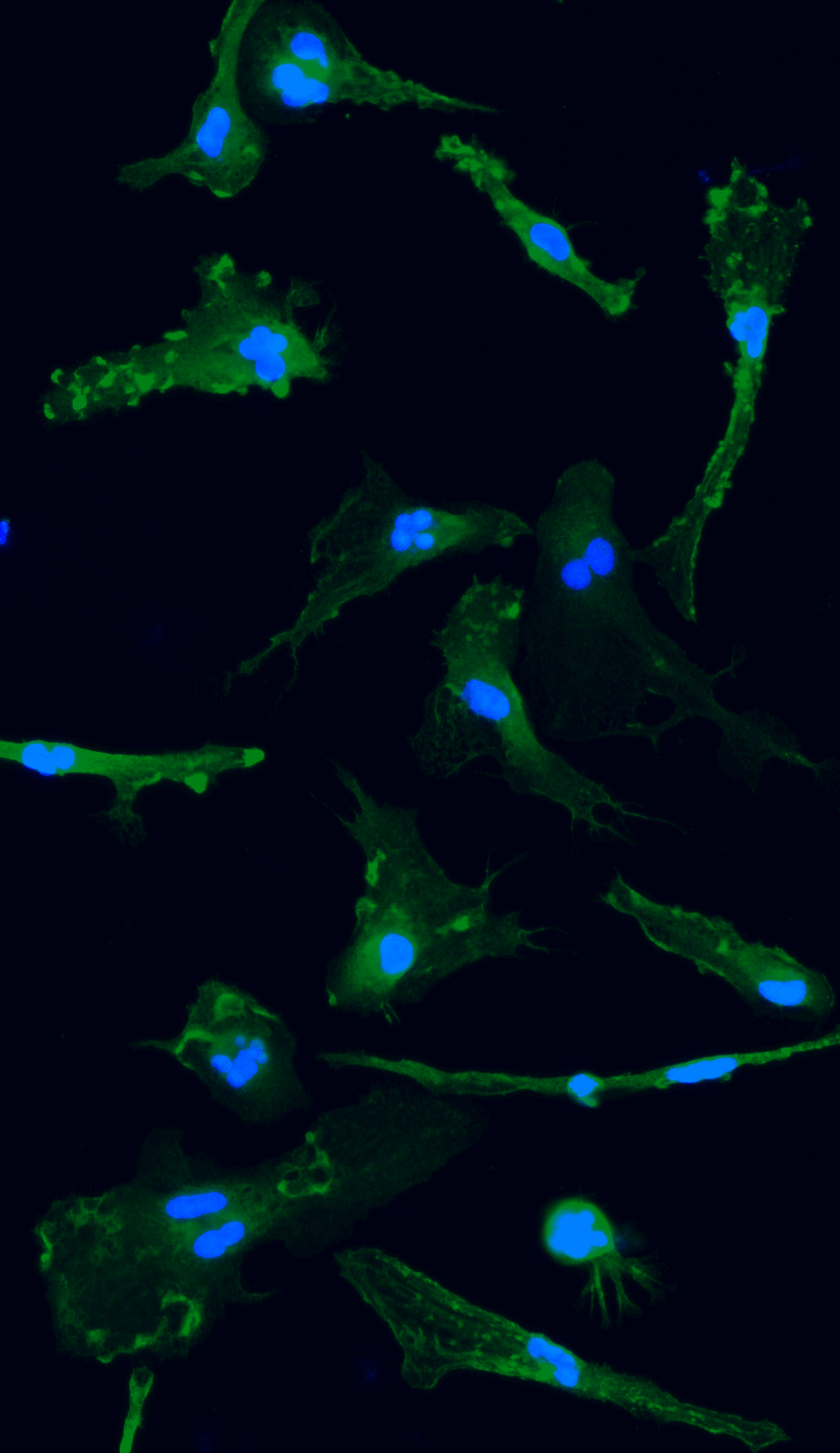 ioMicroglia TREM2 R47H/WT