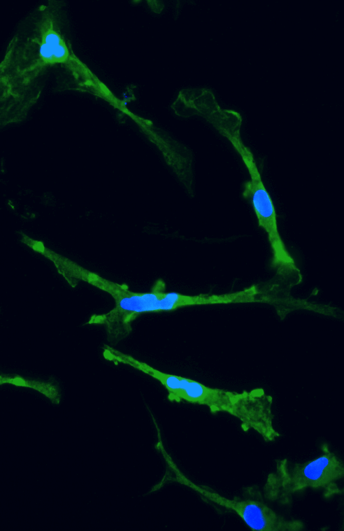 ioMicroglia TREM2 R47H/R47H