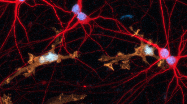 Sartorius application note - Advanced in vitro Modeling of Human iPSC-derived Neuronal Mono- and Co-cultures with Microglia