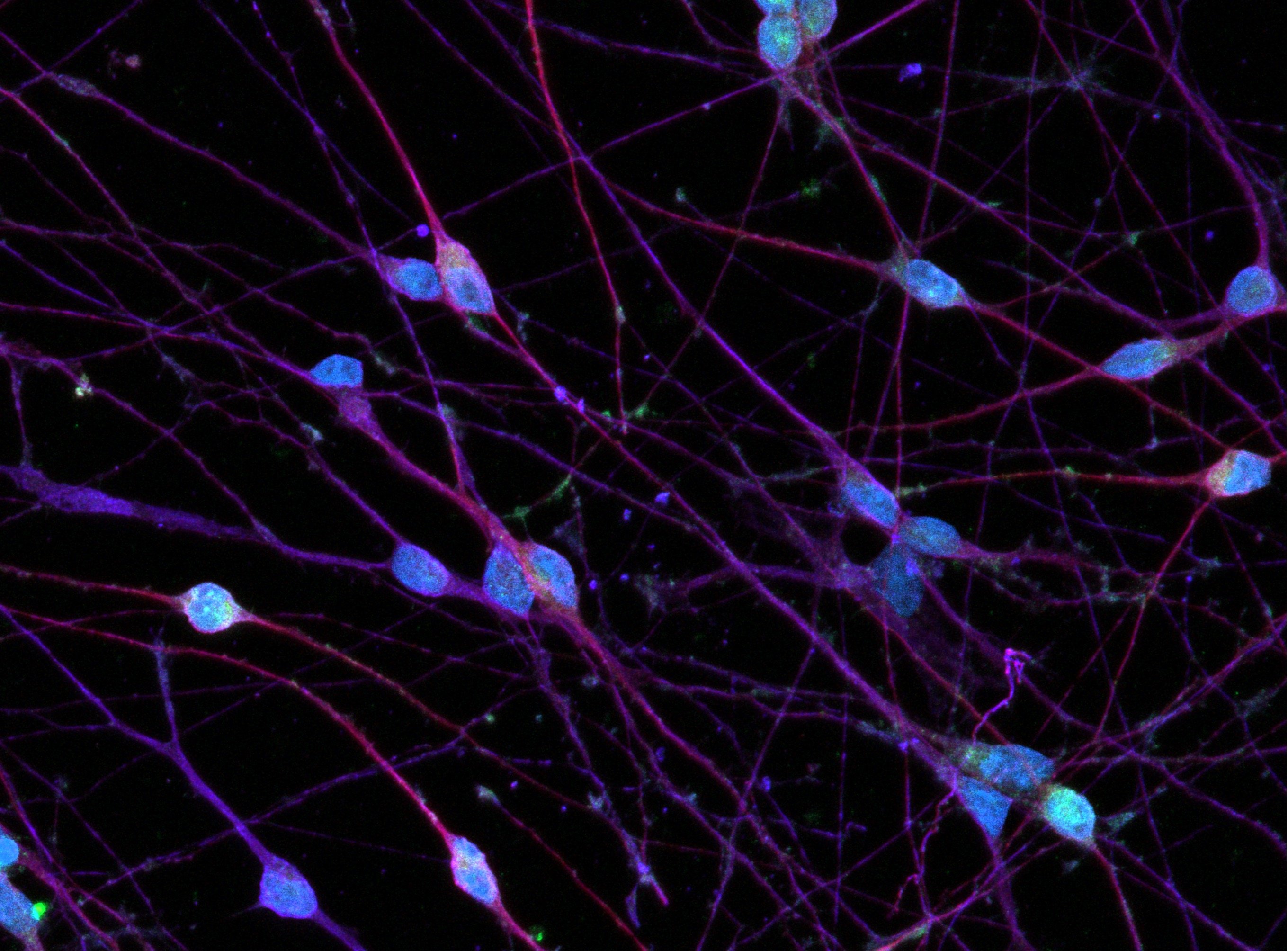 bit.bio_ioGlutamatergic Neurons About us