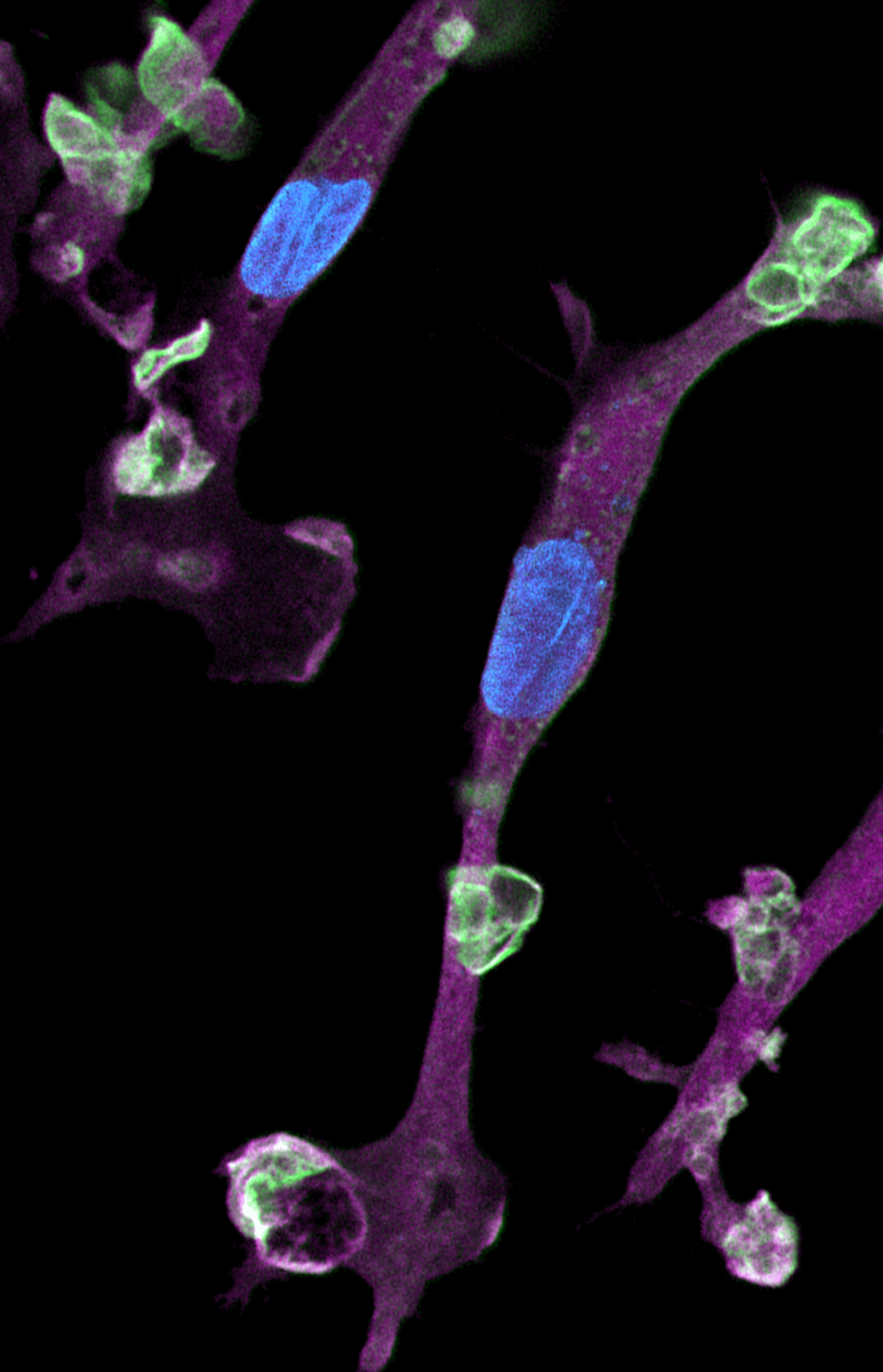 Sex differences in neurological research