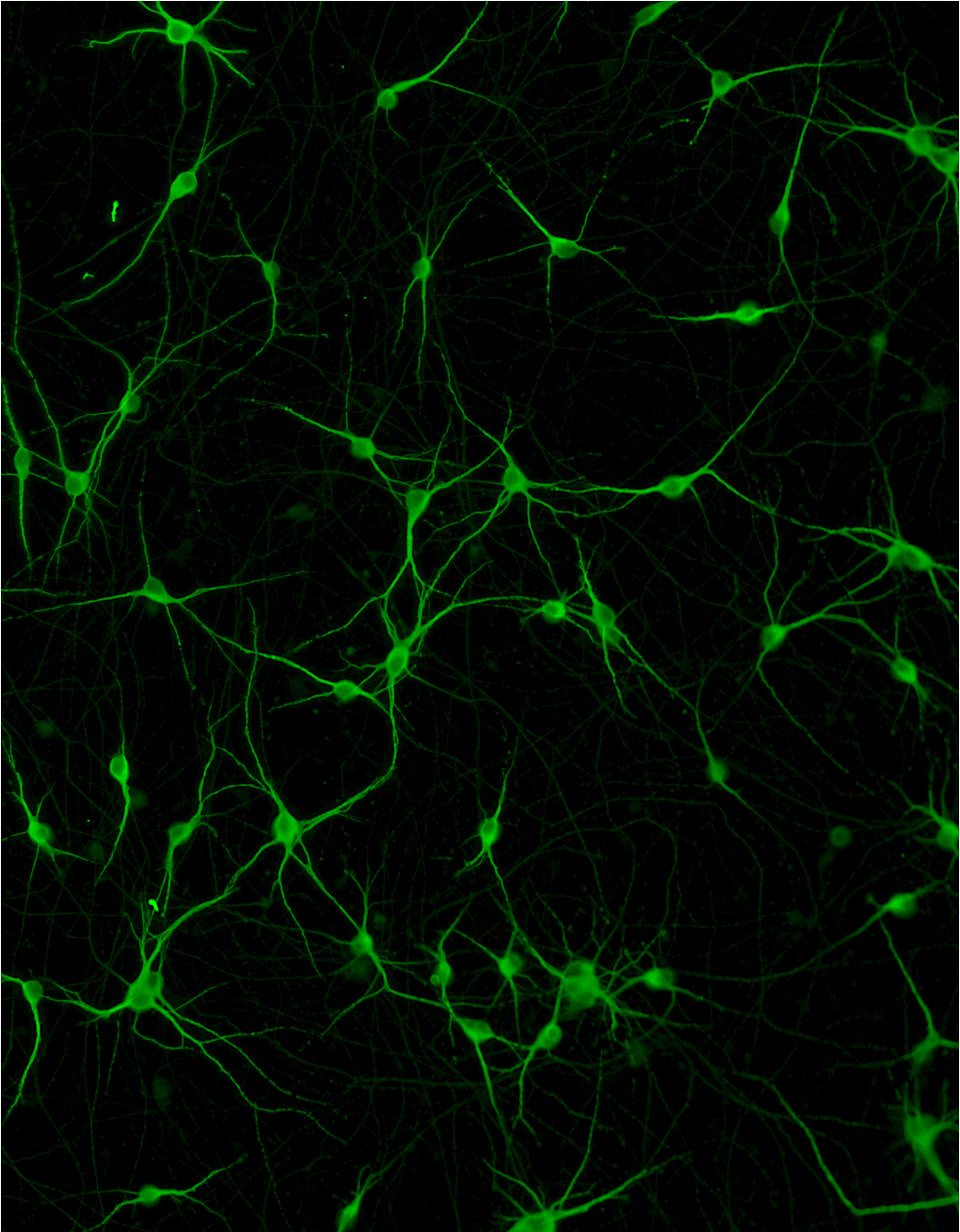 ioMotor Neurons SOD1 G93A/WT